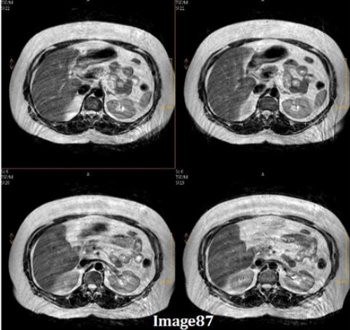 <p><span><strong>Image 87 displays what kind of artifact?</strong></span></p>