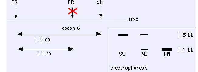 <p>The site (ER) is normally recognized and cleaved by restriction enzyme at the 6th codon in B-globin, producing a DNA fragment of 1.1 Kb.</p><p>• The mutation eliminates this site at codon 6 that leads to generation of 1,3 Kb fragment.</p><p>• Sothern blot can discriminate between the normal homozygotes (NN), heterozygotes (NS) and affected homozygotes (SS) individuals.</p>