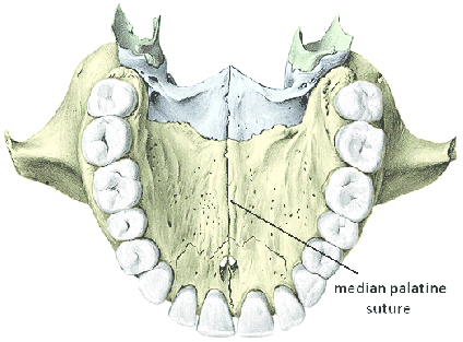 <p><strong>Median palatine suture: </strong>The <strong>bony union</strong> where the right and left palatine processes of the maxilla fuse in the midline.</p><ul><li><p>Location: Runs along the center of the hard palate, beneath the median palatine raphe.</p></li></ul><p></p>