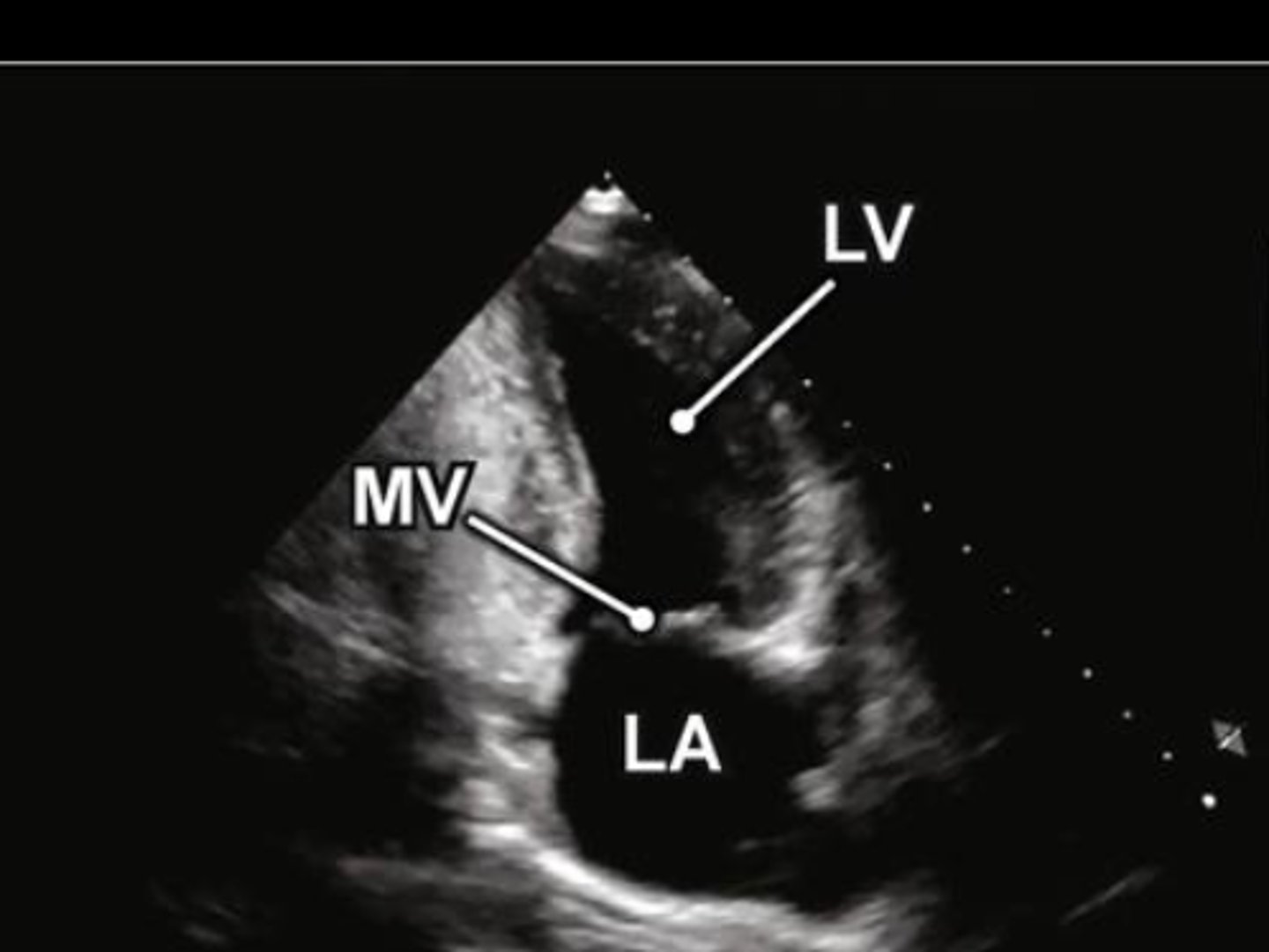 <p>A2 is used to visualize _____</p>