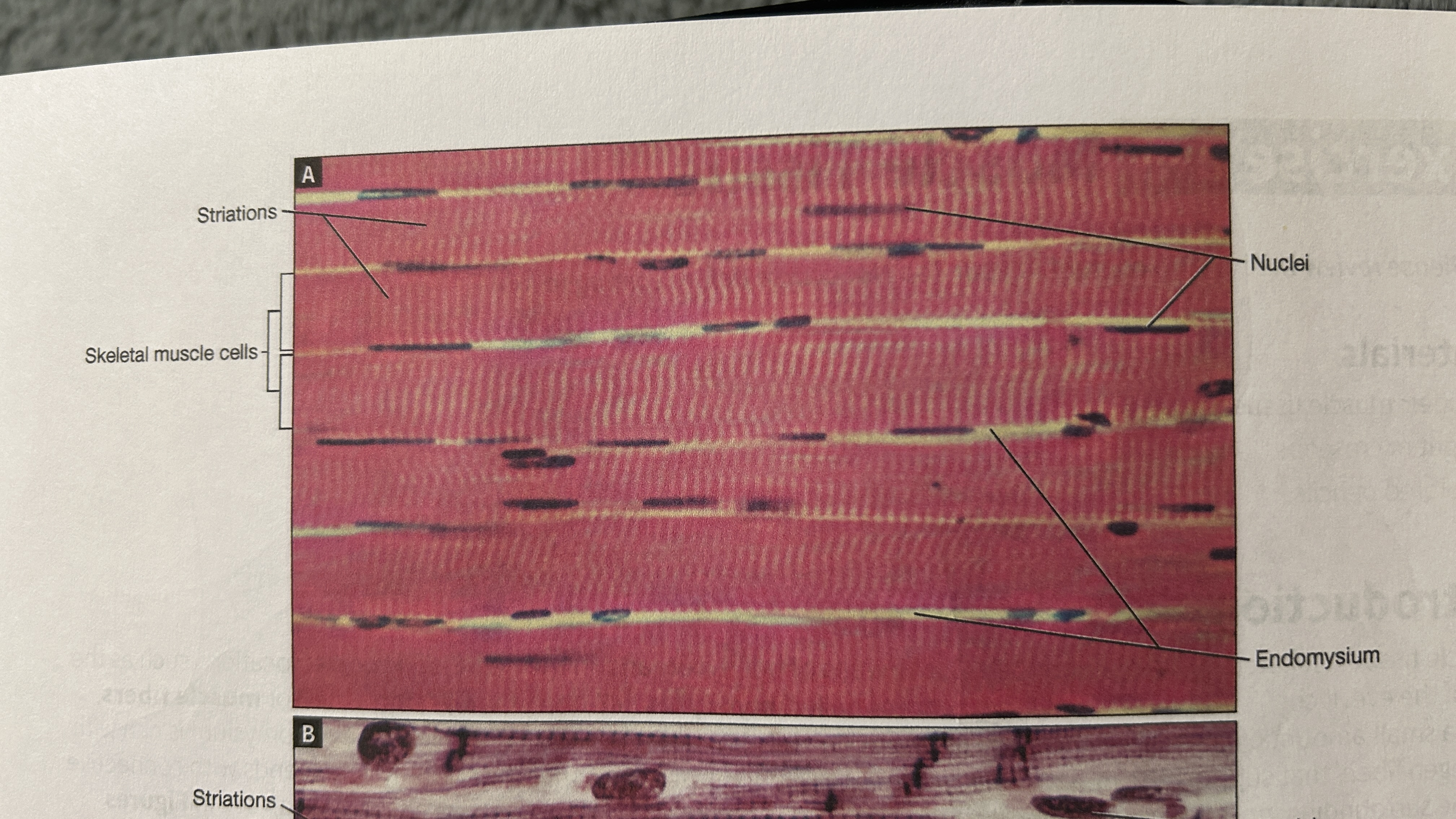 <p>Skeletal Muscle Tissue </p>