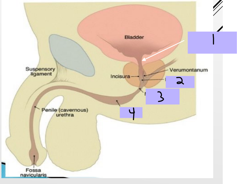 <p><strong>Male Urethra</strong></p><p>-____ (20 cm)</p><p>-<strong>Preprostatic Urethra (#1)</strong></p><ul><li><p>Extends from _____ of bladder to the ________</p></li><li><p>Associated with cuff of smooth muscle fibers called the ________ urethral sphincter</p></li><li><p>Prevents _________ movement of _______ into bladder during ejaculation</p></li></ul><p>-<strong>Prostatic Urethra (#2)</strong></p><ul><li><p>Surrounded by _________</p></li><li><p>Prostate gland and ejaculatory _______ open up into this portion</p></li></ul><p><strong>-Membranous Urethra (#3)</strong></p><ul><li><p>__________ and passes through the deep perineal pouch</p></li><li><p>Surrounded by _________ muscle (external urethral sphincter)</p></li></ul><p><strong>-Bulbar/Penile/Spongy Urethra (#4)</strong></p><ul><li><p>Surrounded by ________ tissue (corpus spongiosum) of penis</p></li><li><p>Enlarged at base and end of _______</p></li><li><p>Exits penis through sagittal ____ (external urethral orifice)</p></li></ul><p></p>