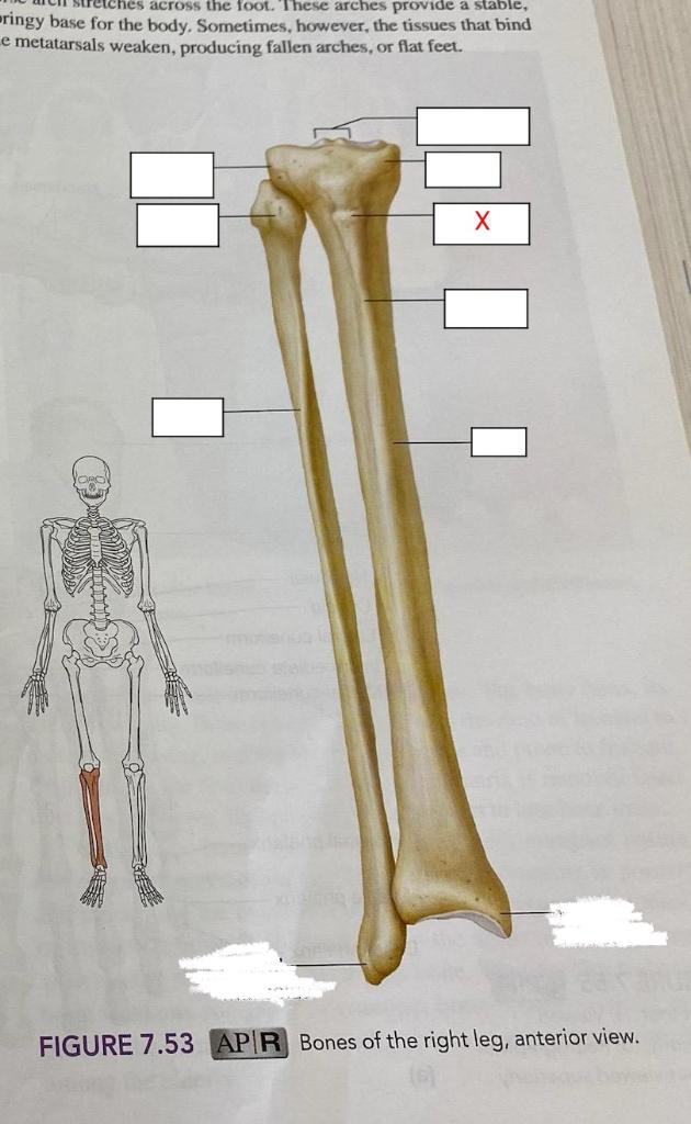 attachment site of patellar ligament