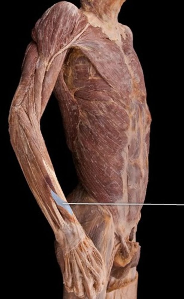 <p>What muscle is this?</p>