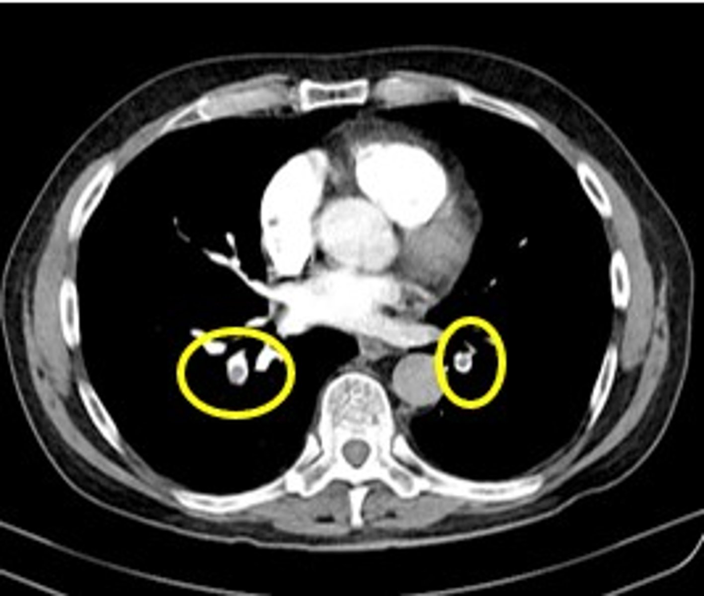 <p>Label pathology in image below</p>