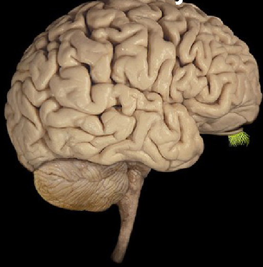 term image