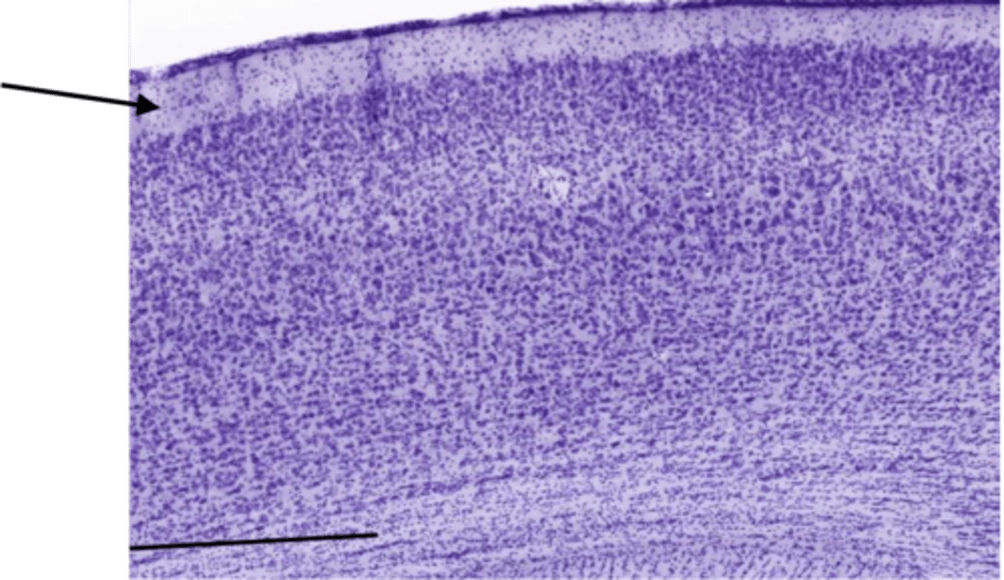<p>Identify the layer of the cerebrum</p>