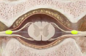 <p>what is the yellow color indicating in the spinal cord cross section</p>