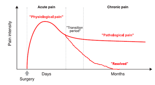 acute-to-chronic pain transitioning