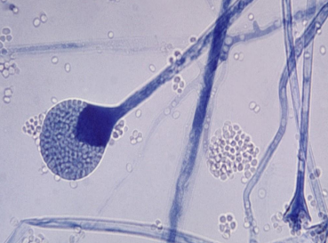 <p>What opportunistic mold looks like a <strong>lightbulb</strong>?</p>