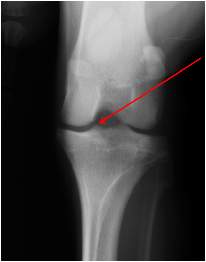 <p>identify this structure</p>