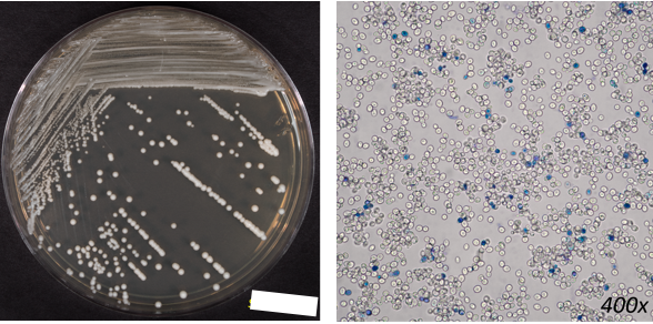 <ul><li><p>important non-pathogenic yeast</p></li><li><p>name means “sugar fungus that makes beer”</p></li><li><p>brewers yeast - used to produce beer, wine, and bread</p></li><li><p>fermentation produces CO2 gas and ethanol (alcohol)</p></li></ul><p></p>