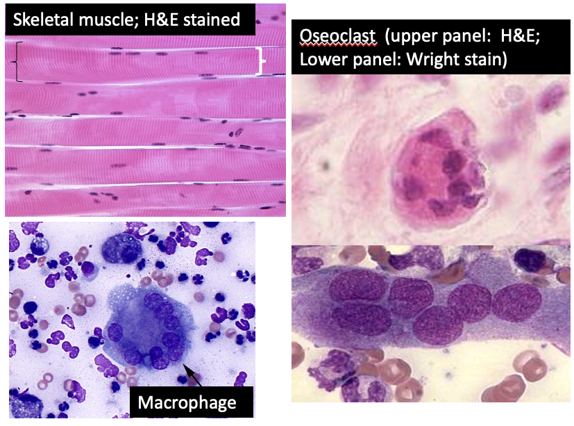 <ul><li><p>osteoclasts</p></li><li><p>skeletal muscle</p></li><li><p>inflammatory macrophages</p></li></ul><p></p>