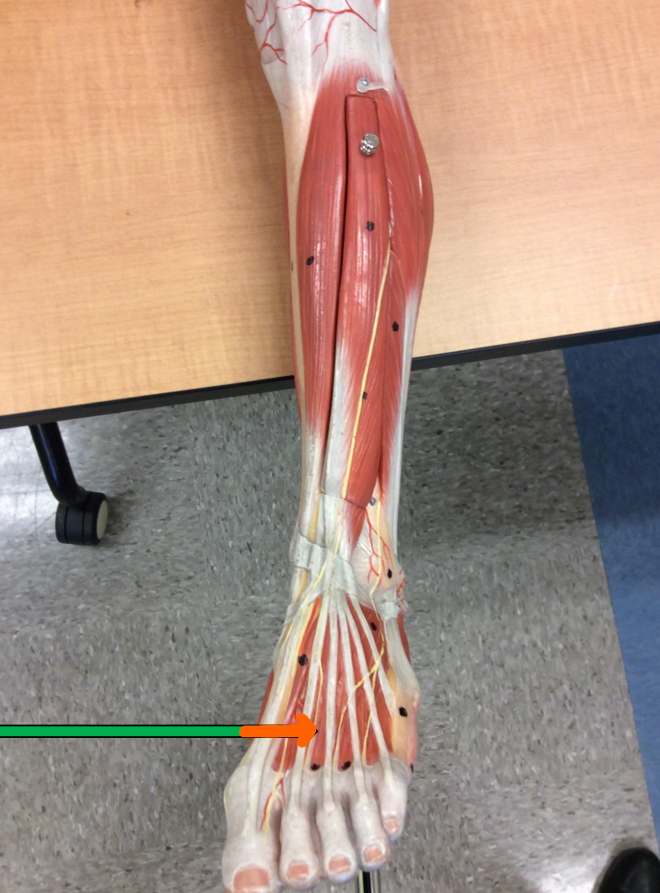 <p>Identify this muscle?</p>