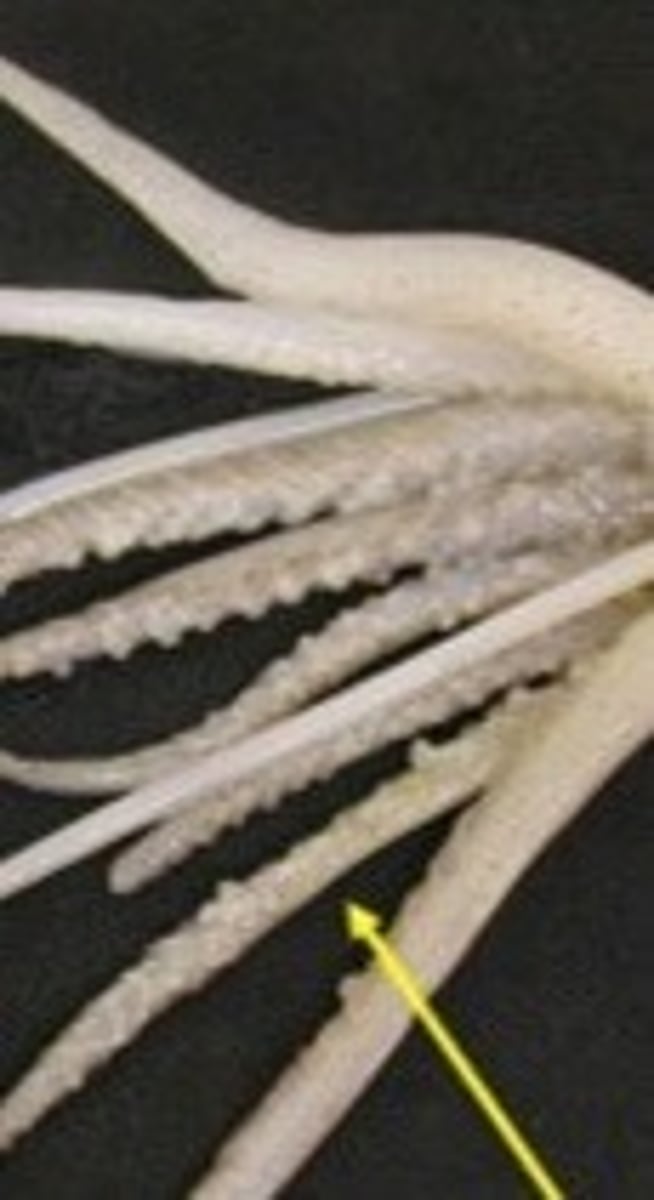 <p>8 appendages that are covered with suction cups.</p>