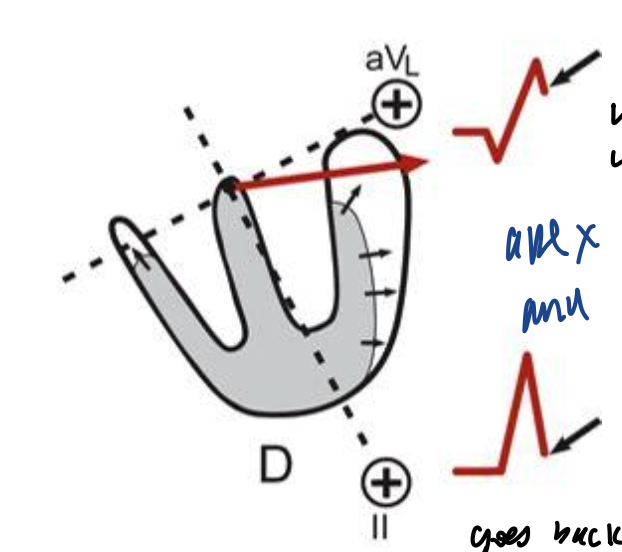 <p><strong>The Electrocardiogram</strong></p><p>What is happening here?</p>