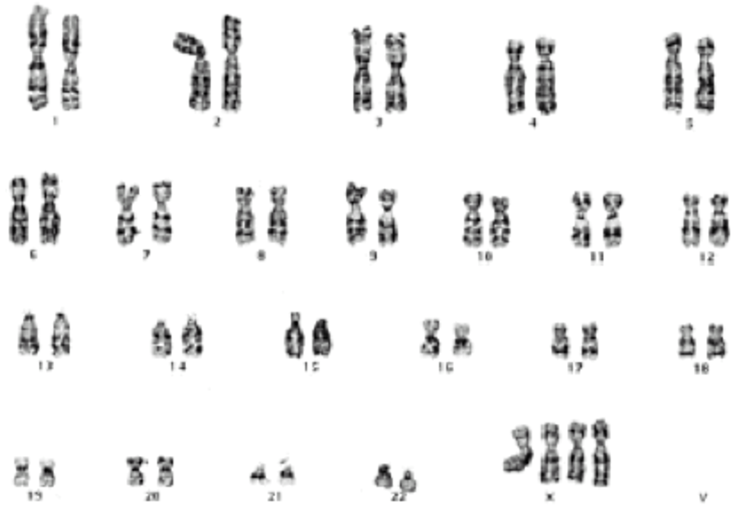 <p>gain of two homologous chromosomes (2n+2)</p>