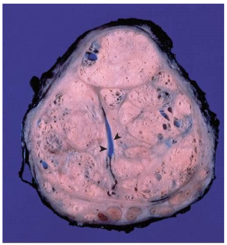 <p>What is the diagnosis?</p>