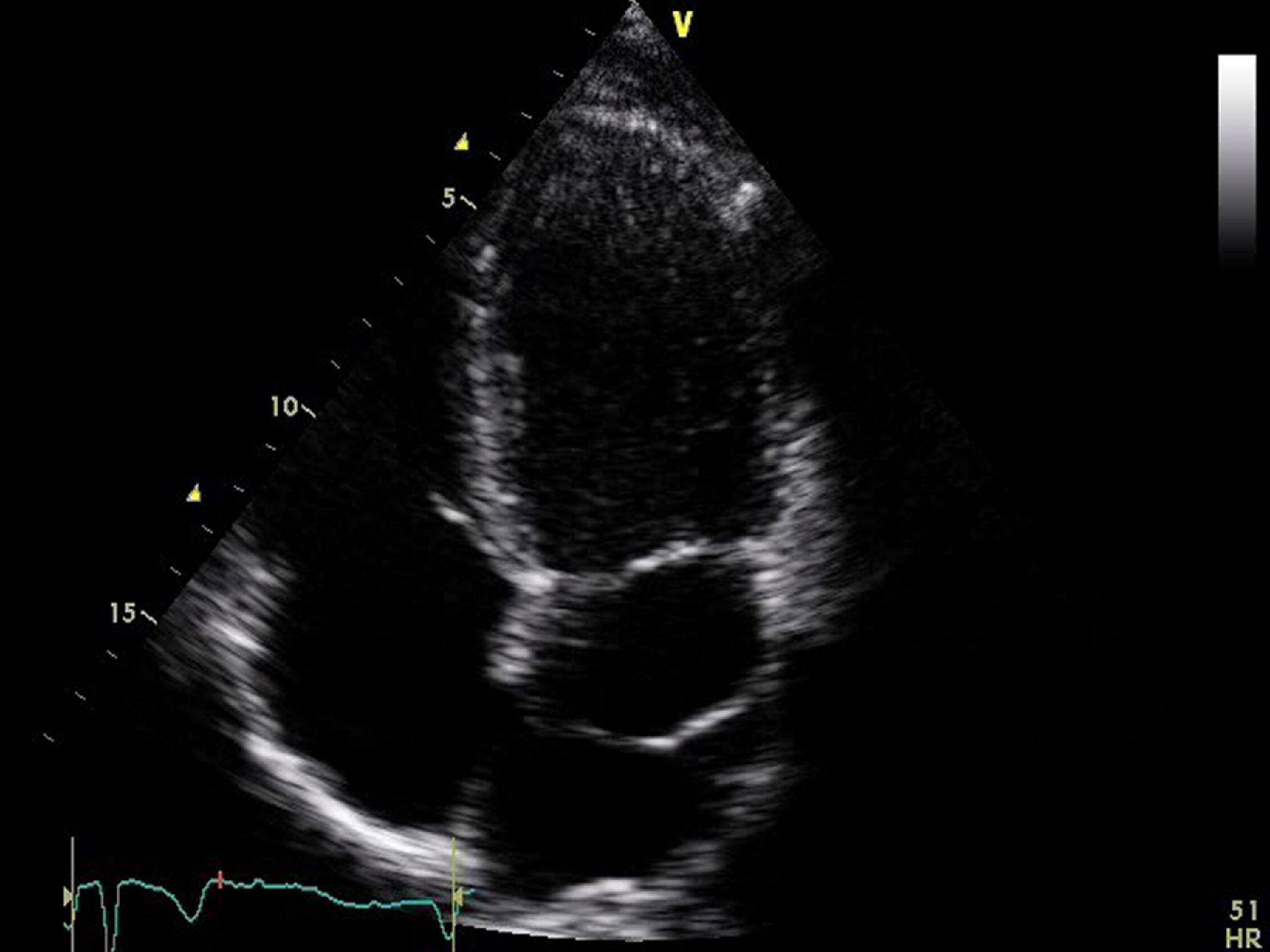 <p>What is seen in the 2D image?</p>