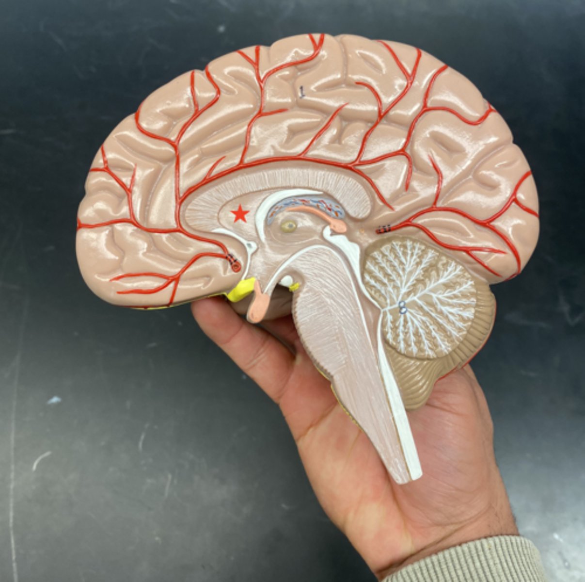 <p>is a thin, transparent membrane located in the midline of the brain, separating the two lateral ventricles.</p>