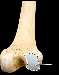 <p>Femur, posterior view, right side, distal end</p>
