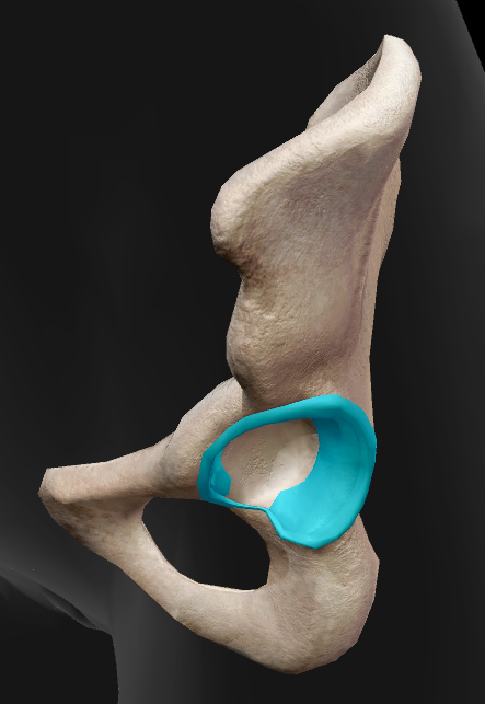 term image