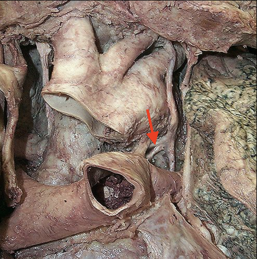 <p>What nerve is this</p>