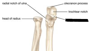 <p>coronoid process</p>