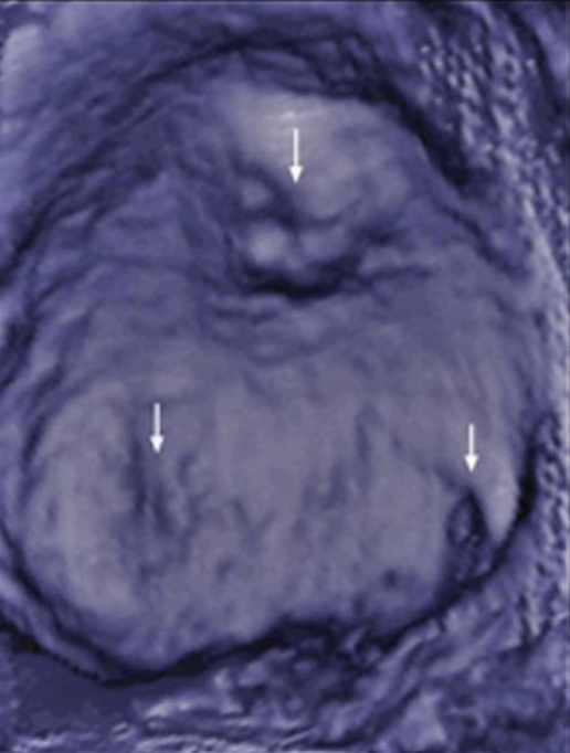 <p>Describe the anatomy of the trigone</p>