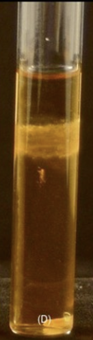 <p>What type of aerobe or anaerobe is this? (extra points if u can name the bacteria used)</p>