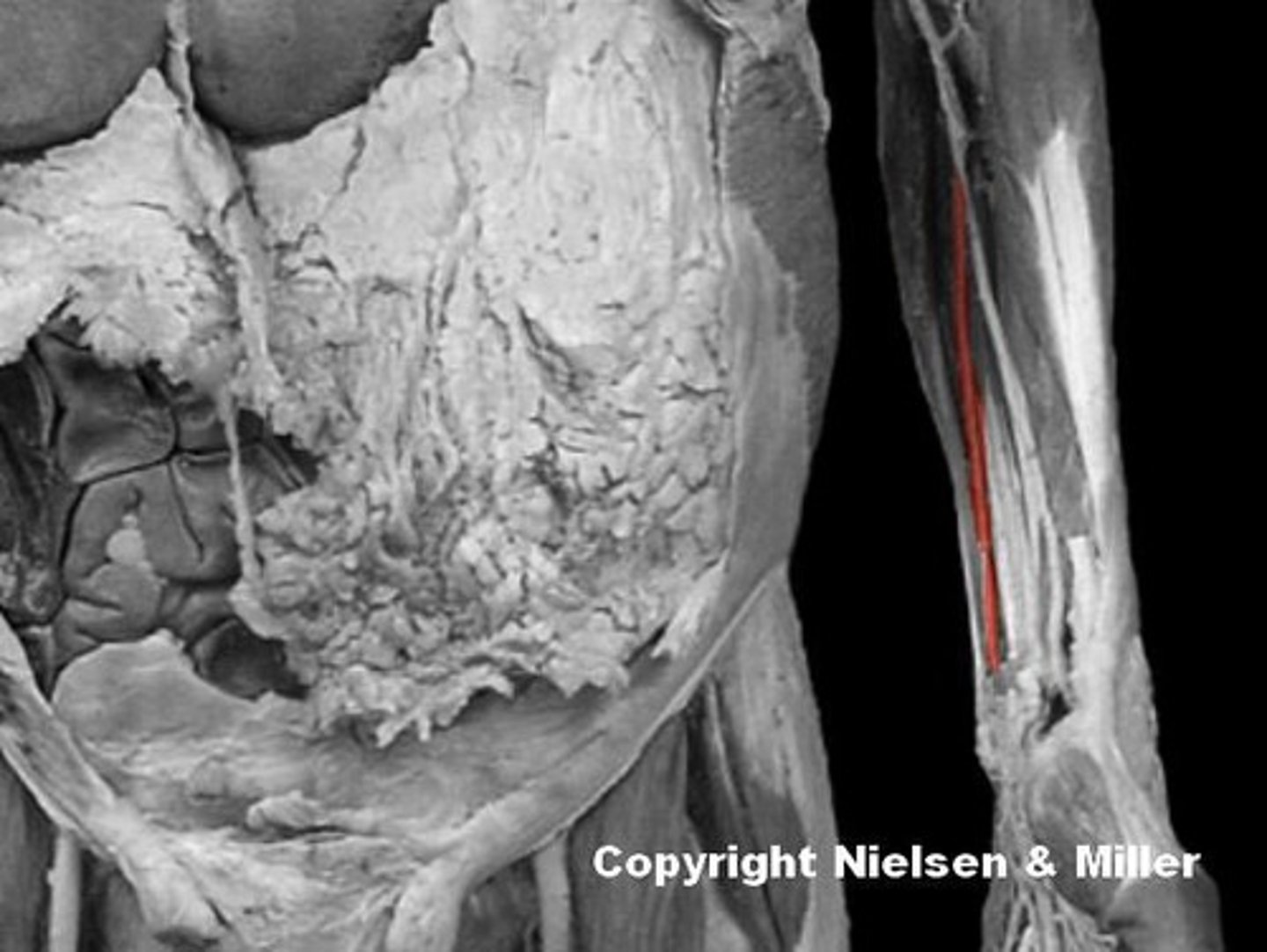 <p>Identify the highlighted vessel.</p>