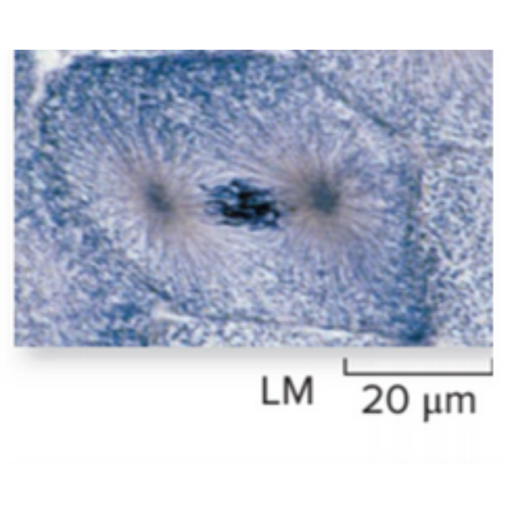 <p>What kind of cell is shown? Name the phase that it is experiencing.</p>