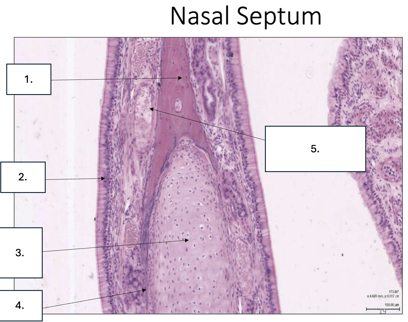 <p>What is number 2?</p>
