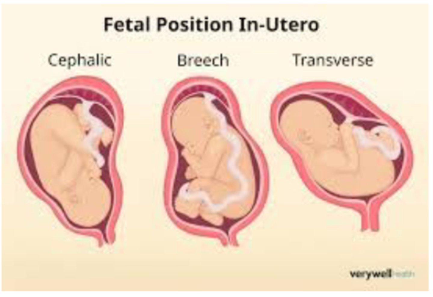 <p>-more than 99 percent of of labor at term, the fetal is longitudinal </p><p>-ethier head or breech </p>