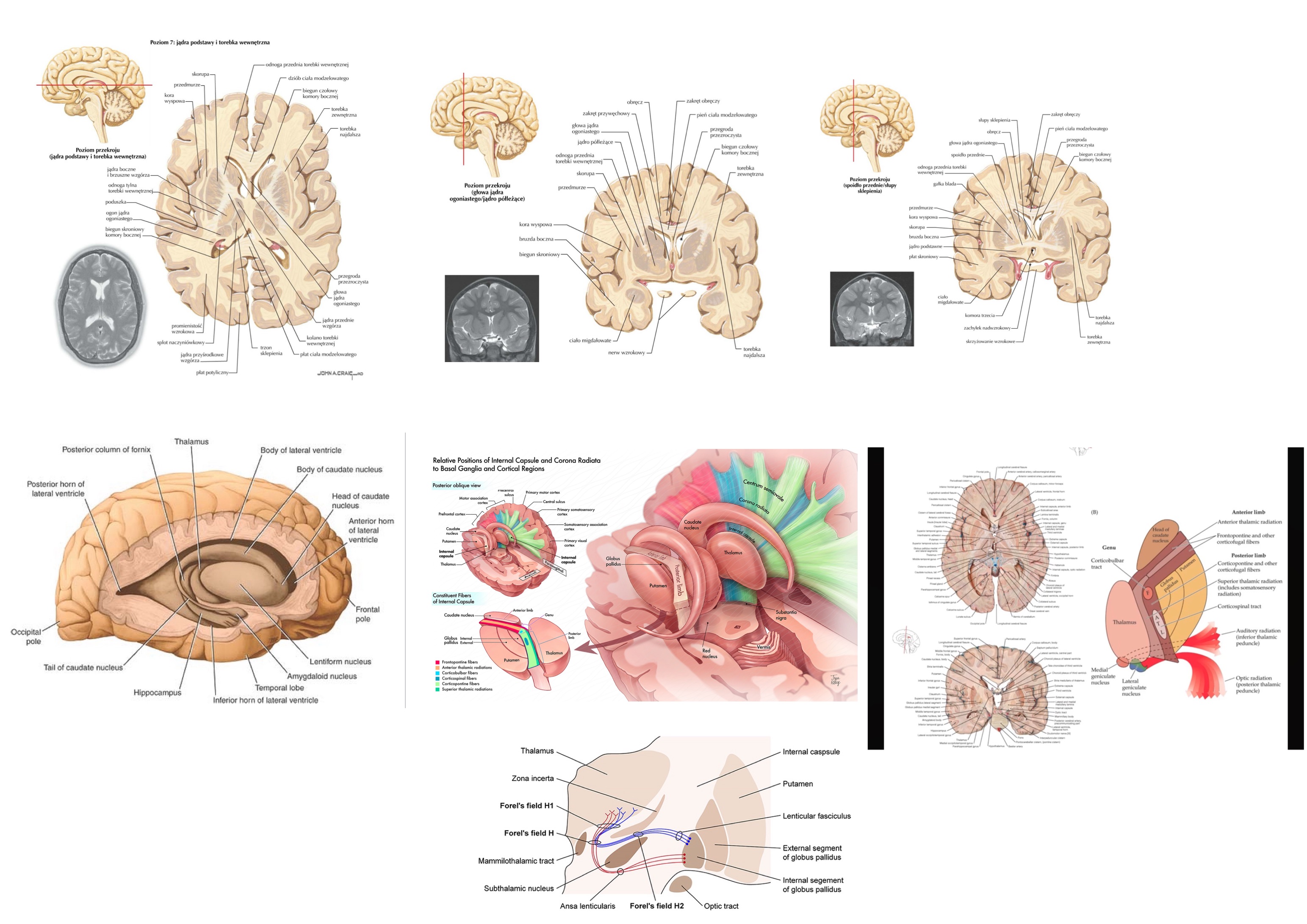 <ul><li><p>odnoga przednia</p><ul><li><p>droga czołowo-mostowa</p></li><li><p>konar przedni wzgórza</p></li></ul></li><li><p>kolano </p><ul><li><p>droga korowo-jądrowa</p></li><li><p>część&nbsp;promienistości wzgórza (część&nbsp;włókien konara górnego wzgórza, które dochodzą&nbsp;do tylnej części płata czołowego i do płata ciemieniowego)</p></li></ul></li><li><p>odnoga tylna</p><ul><li><p>droga korowo-rdzeniowa przez 2/3 przednie odnogi tylnej</p></li><li><p>część&nbsp;promienisotści wzgórzowej czyli część&nbsp;włókien konara górnego wzgórza</p></li><li><p>droga korowo-czerwienna</p></li><li><p>droga potyliczno-mostowa</p></li><li><p>droga skroniowo-mostowa</p></li></ul></li><li><p>część&nbsp;zasoczewkowa </p><ul><li><p>promienistość&nbsp;wzrokowa</p></li><li><p>część&nbsp;promienistości wgórzowej czyli część&nbsp;konara tylnego wzgórza</p></li><li><p>droga korowo-pokrywowa</p></li></ul></li><li><p>część&nbsp;podsoczewkowa torebki wewnętrznej</p><ul><li><p>promienistość&nbsp;wzrokowa</p></li><li><p>promienistość&nbsp;słuchowa</p></li><li><p>droga korowo-pokrywowa</p></li><li><p>droga skroniowo-mostowa</p></li><li><p>ciemieniowo-motowa</p></li><li><p>poytliczno-mostowa</p></li><li><p>część&nbsp;promienistości wzgórzowej czyli konara TYLNEGO wzgórza</p></li></ul></li><li><p>część&nbsp;nadsoczewkowa</p><ul><li><p>część&nbsp;promienistości wzgórzowej czyli konara GÓRNEGO wzgórza</p></li></ul></li></ul><p></p><p>konar dolny wzgórza nie przechodzi przez torebkę&nbsp;wewnętrzną, lecz otacza ją od dołu, biegnąc pod dolną&nbsp;powierzchnią&nbsp;jądra soczewowatego jako jeden ze składników pętli konarowej</p>