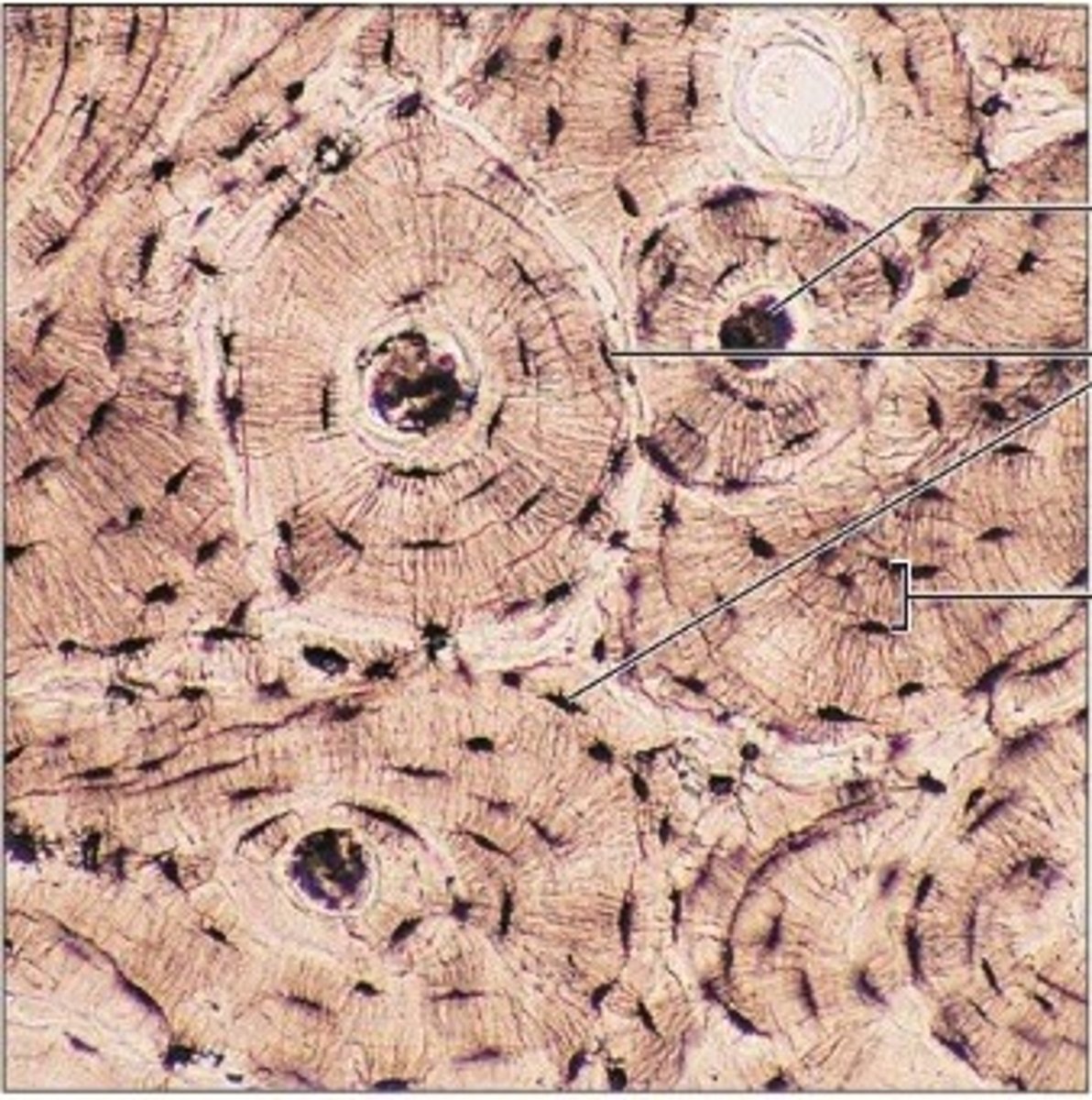 <p>- hard calcified matrix with alot of collagen fibres</p><p>- osteocytes lie in lacunae</p><p>- very well vascularized</p>
