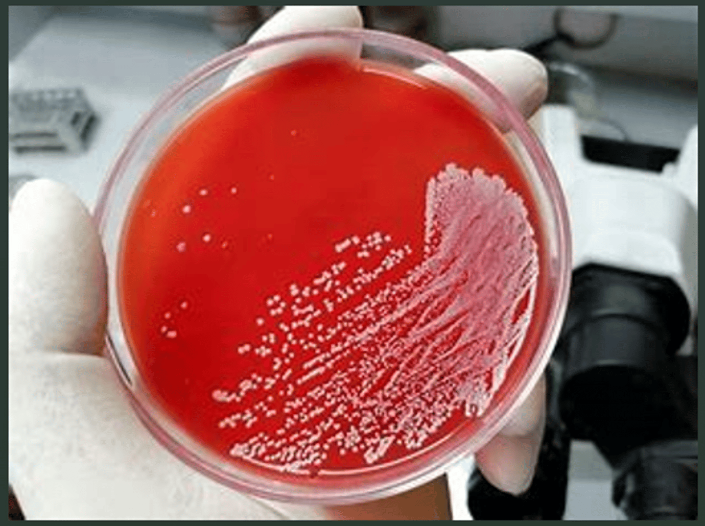<p>identify what type of hemolytic activity</p>