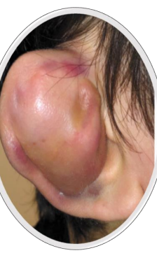 <p>What is this disorder</p>