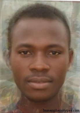<p>Identify this Phenotype</p>