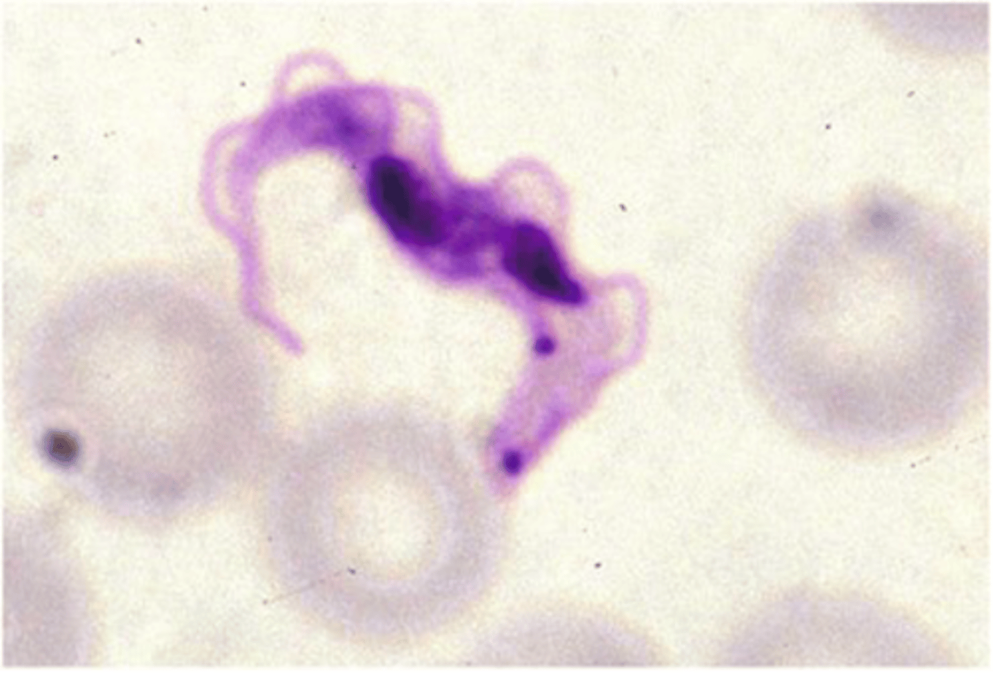 <p>This flagellate found in ruminants and dogs is found in the circulatory system. It is</p><p>transmitted by the bite of an infected fly. It is also a zoonotic protozoan parasite. This parasite is:</p>