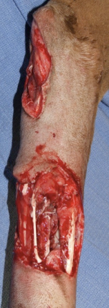 <p>Fat and fascia should be aggressively removed while being more conservative with muscle and skin. Tissue with questionable vitality should be preserved and re-evaluated. Bone, ligaments, and tendons should be preserved unless removal is absolutely necessary. </p>