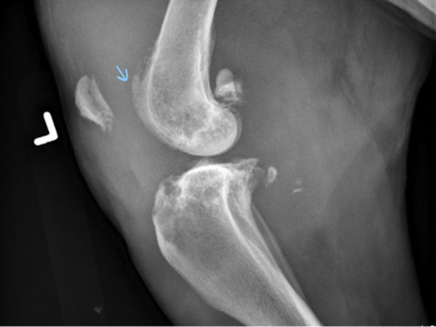 <p>What does this patient have?</p>