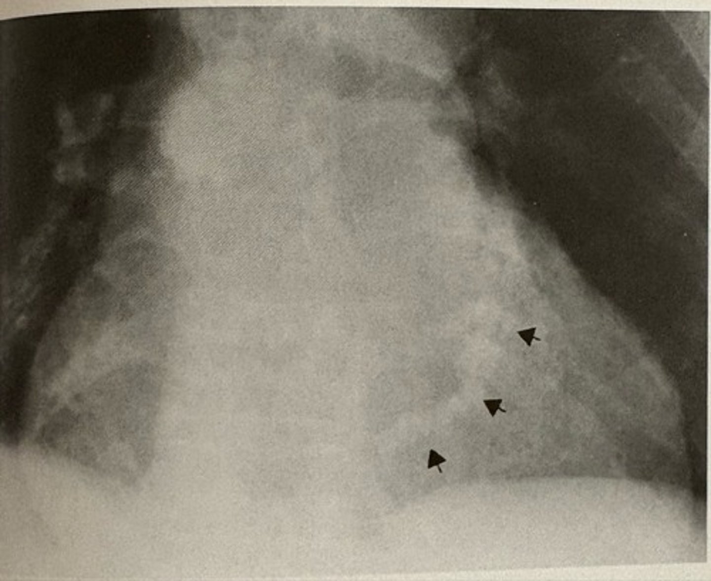 <p>what pathology is present?</p>