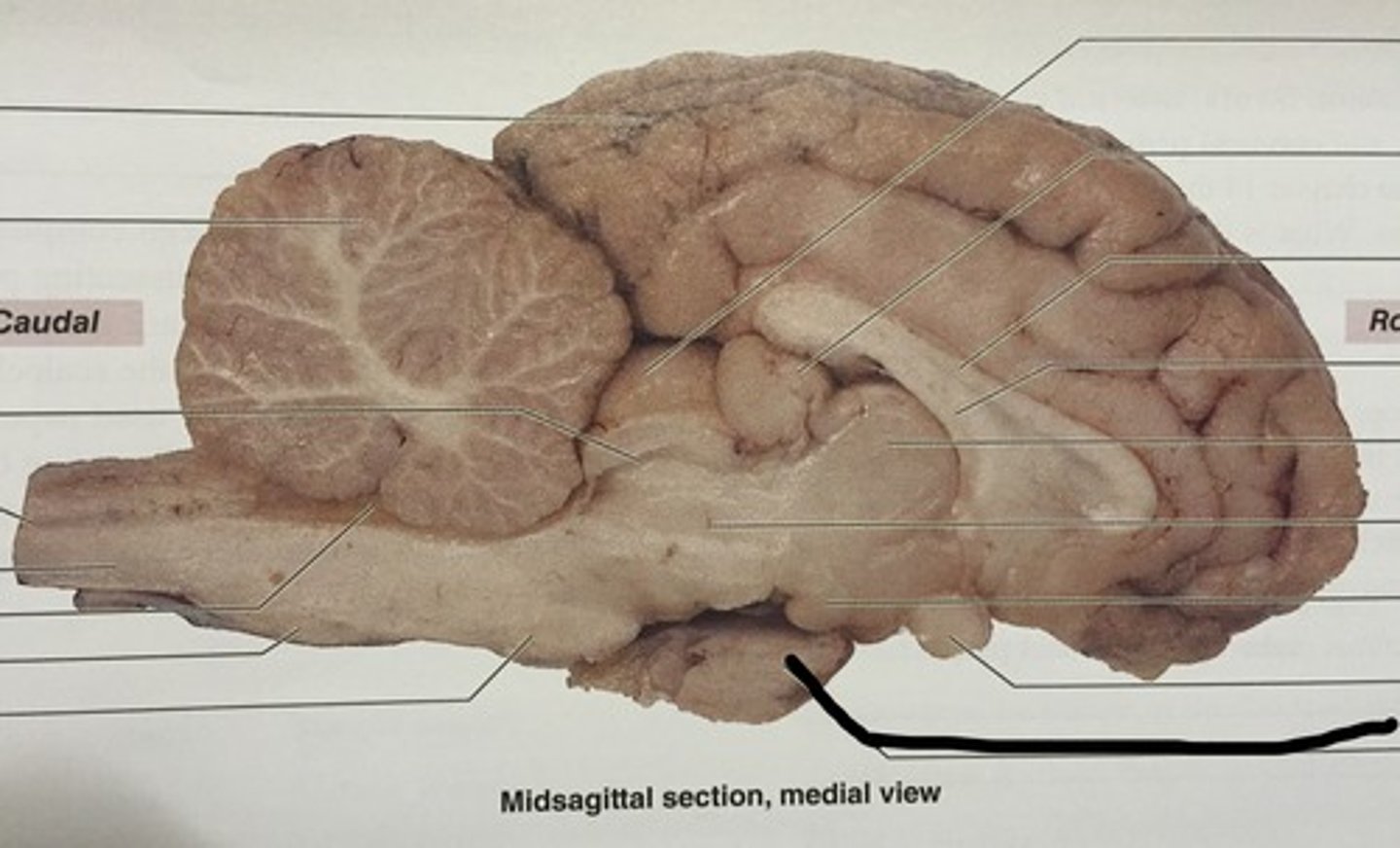 <p>regulates growth; also called they hypophysis; hangs from the hypothalamus of the diencephalon; probably removed when the meninges were dissected</p>