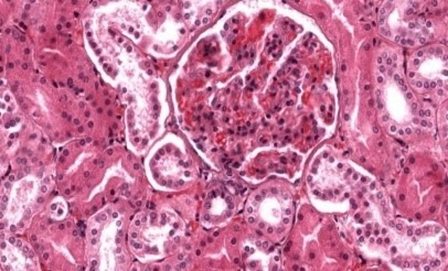<p>the area around renal corpuscles of kidney</p>