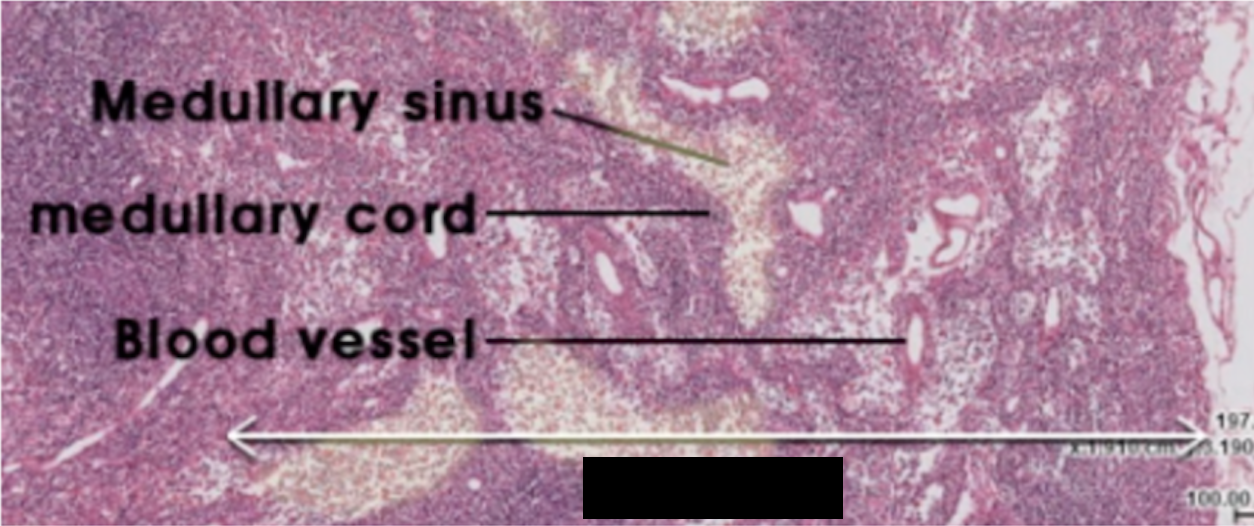 <p><span>has cords of lymphatic tissue containing B-cells, macrophages, antigen presenting cells, and plasma cells</span></p>