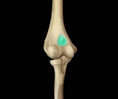 large, medial hollow on anterior side of distal end 