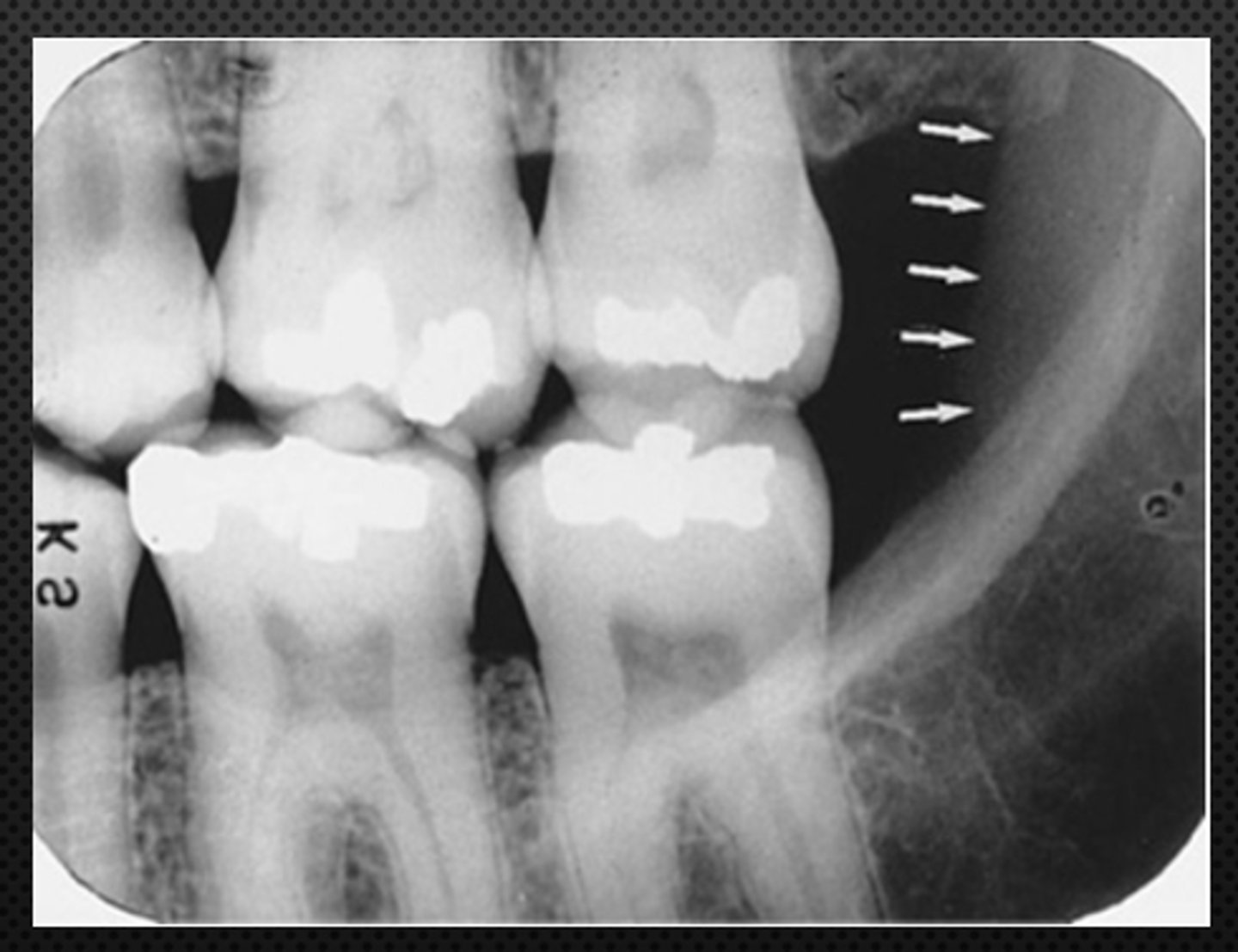 <p>Name the structure the white arrow is pointing to.</p>