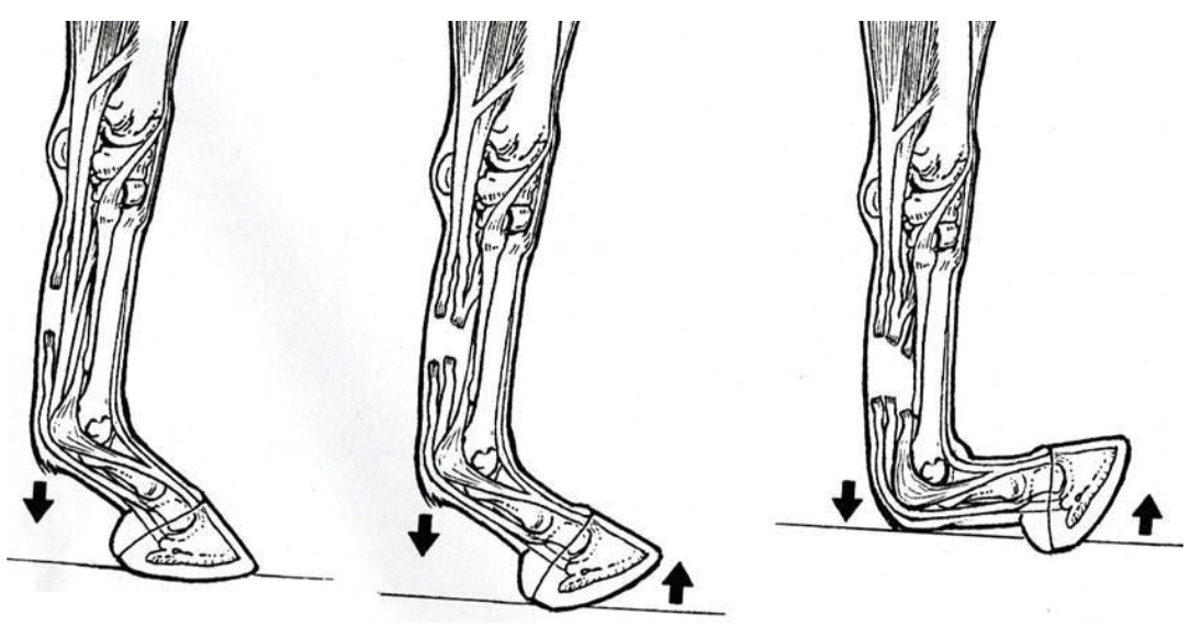 <p>what tendons are torn for these lacerations (L to R)</p>