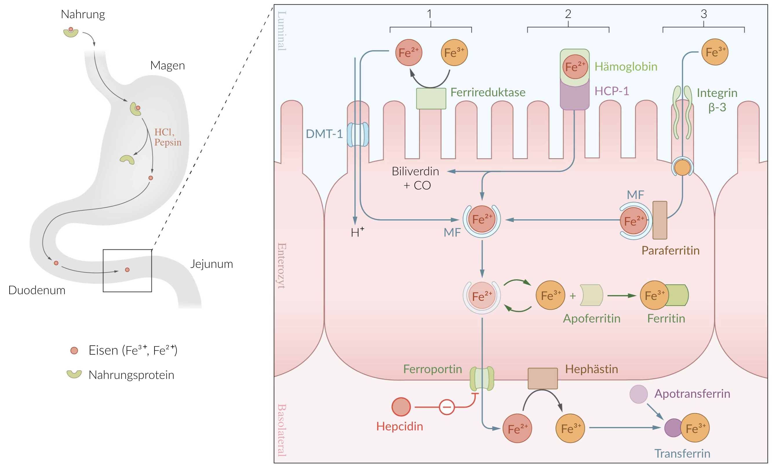 <p>E. Inhibition of ferroportin</p>